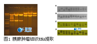 高通量組織研磨儀研磨胰腺腫瘤提取RNA的實(shí)驗(yàn)步驟